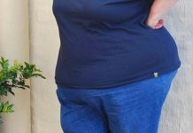 Santie Pretorius lost more than 100kg after undergoing bariatric surgery