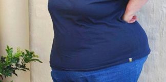 Santie Pretorius lost more than 100kg after undergoing bariatric surgery