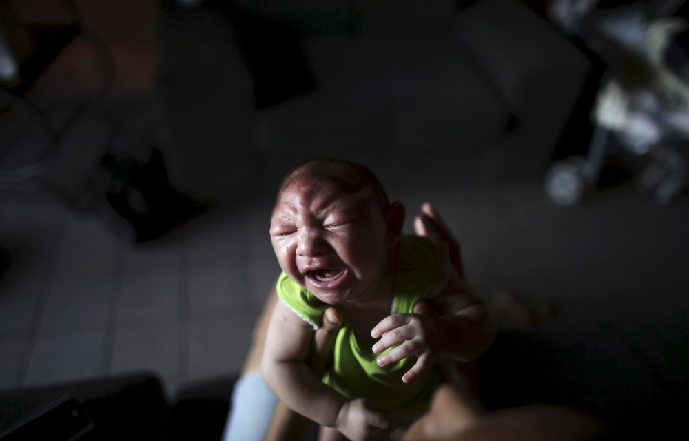 Zika: What you need to know