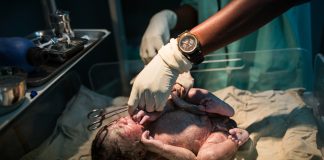 In good hands: Mozambique's nurses take up the scalpel for safer births