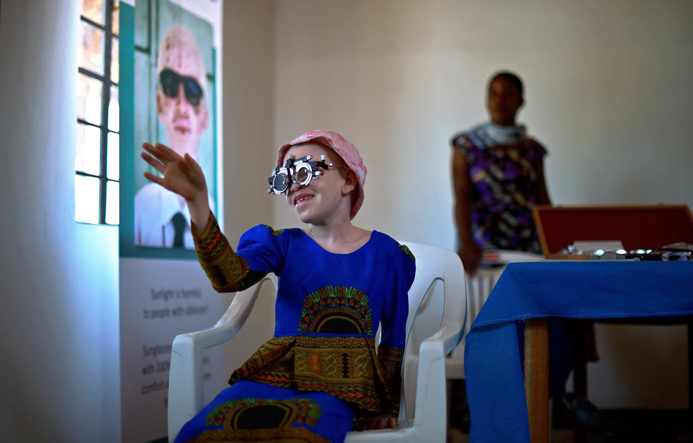 A girl living with albinism has her eyes tested. A new regional plan by the African Commission on Human and People's Rights calls for the affordable provision of eye care and sunscreen to people living with the condition.