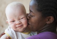 Victims of superstition: The dangers of living with albinism in Africa