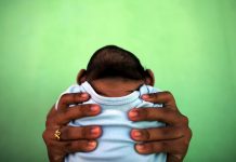 The Zika link: Small heads and brains
