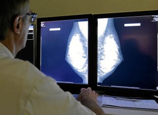 Mammography is still the gold standard of breast screening.