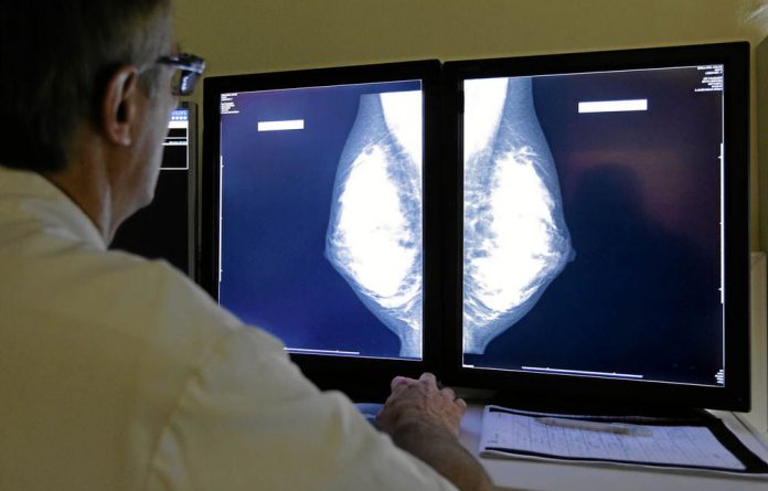 Mammography is still the gold standard of breast screening.
