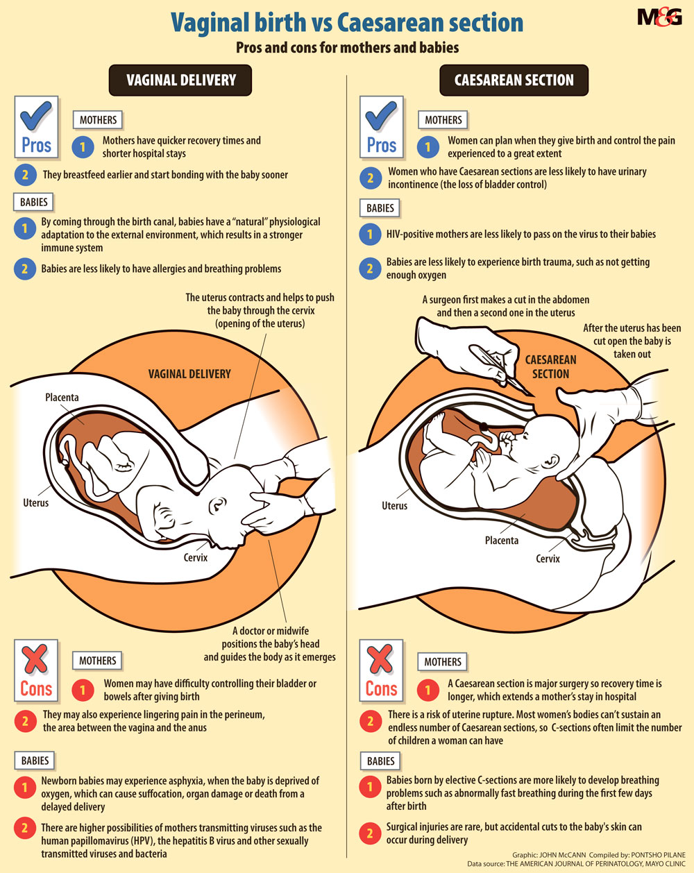 The Pros And Cons Of C Sections And Vaginal Births Bhekisisa 